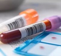 Prostatitis Labordiagnose