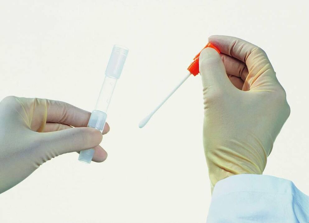 Sammlung von Analysen zur Erkennung chronischer Prostatitis