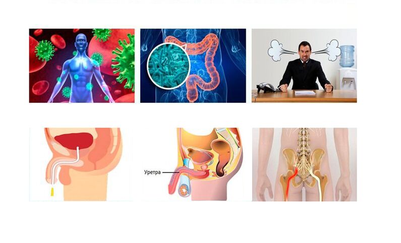Ursachen der Prostatitis
