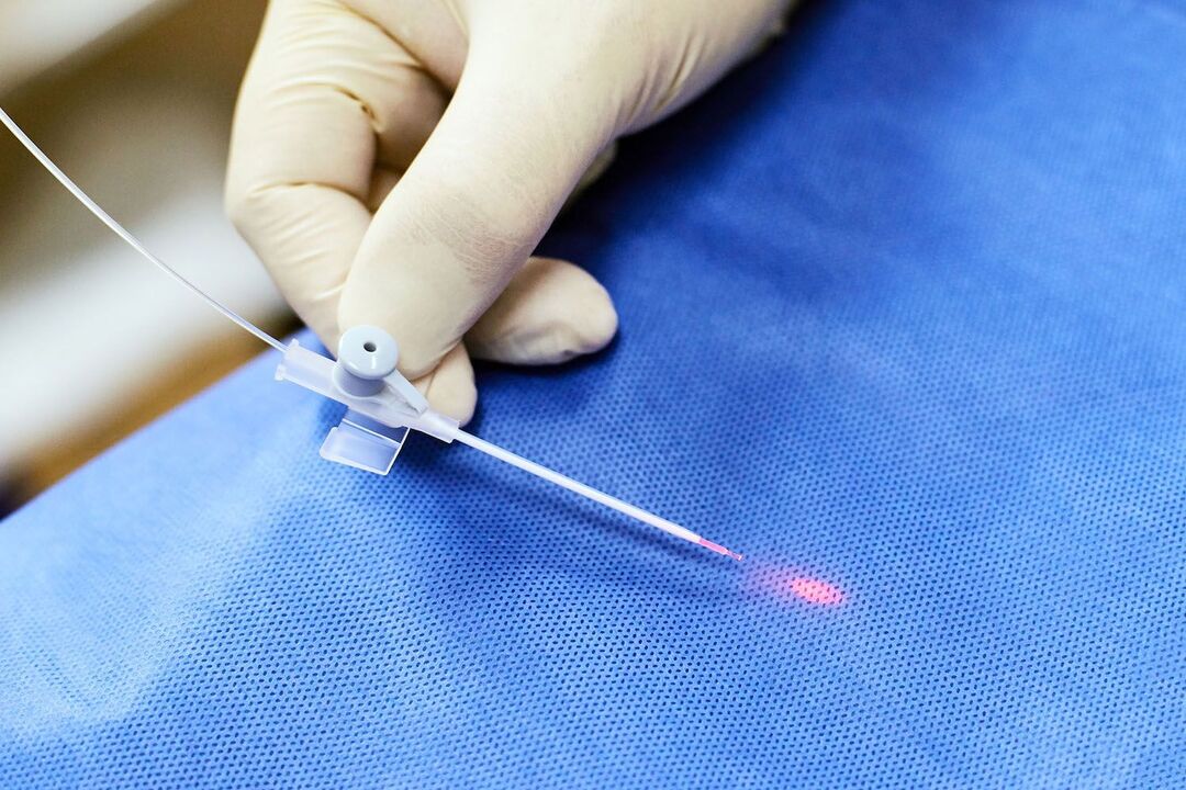 Transrektales Gerät zur Prostatabehandlung